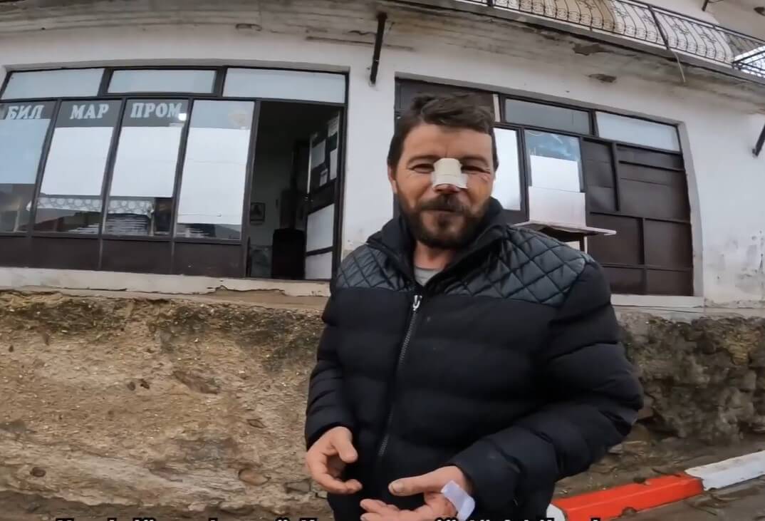 Polici i dehur rrah brutalisht personin me nevoja të veçanta
